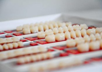 Fatete dentare pentru corectarea inestetica a dintilor frontali