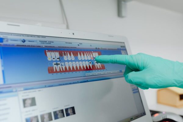 Cine poate apela la implanturile dentare